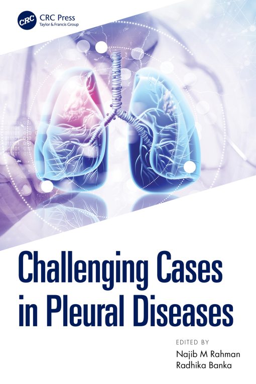 Challenging Cases In Pleural Diseases (EPUB)