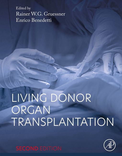 Living Donor Organ Transplantation, 2nd Edition (EPUB)