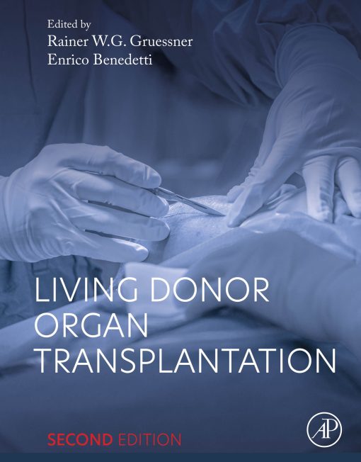 Living Donor Organ Transplantation, 2nd Edition (PDF)