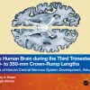 The Human Brain During The Third Trimester 260– To 270–Mm Crown-Rump Lengths: Atlas Of Central Nervous System Development, Volume 12 (EPUB)