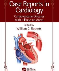 Case Reports In Cardiology: Cardiovascular Diseases With A Focus On Aorta (EPUB)