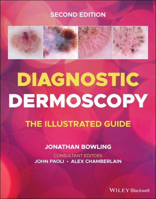 Diagnostic Dermoscopy: The Illustrated Guide, 2nd Edition (EPUB)