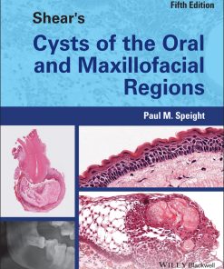 Shear’s Cysts Of The Oral And Maxillofacial Regions, 5th Edition (EPUB)