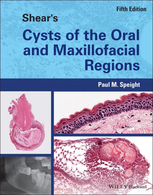 Shear’s Cysts Of The Oral And Maxillofacial Regions, 5th Edition (EPUB)