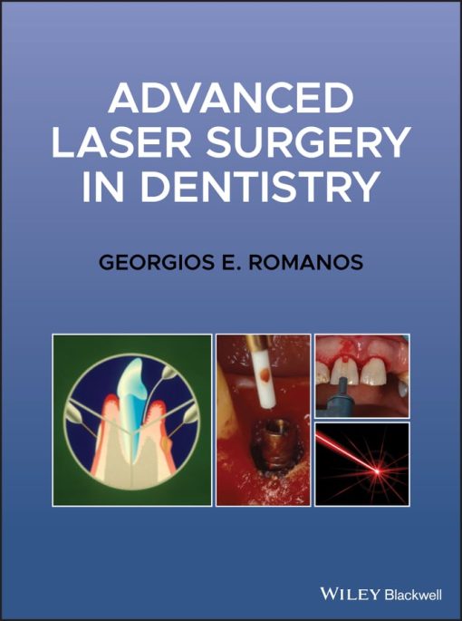 Advanced Laser Surgery In Dentistry (EPUB)