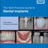 The ADA Practical Guide To Dental Implants (EPUB)