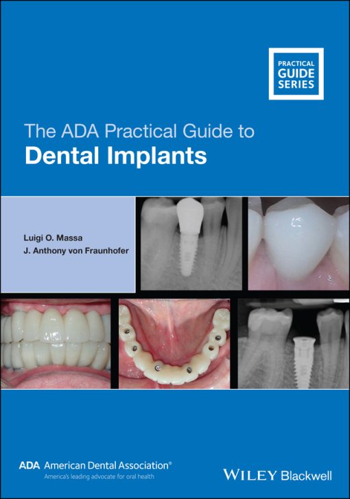 The ADA Practical Guide To Dental Implants (EPUB)