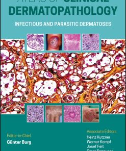 Atlas Of Clinical Dermatopathology: Infectious And Parasitic Dermatoses (EPUB)