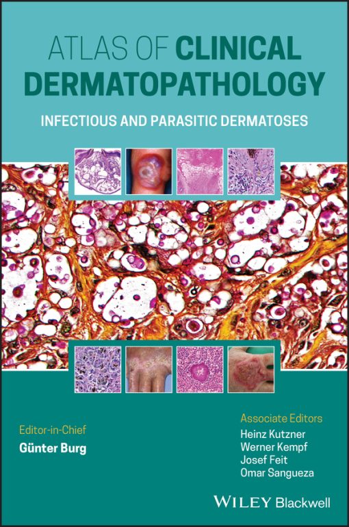 Atlas Of Clinical Dermatopathology: Infectious And Parasitic Dermatoses (EPUB)