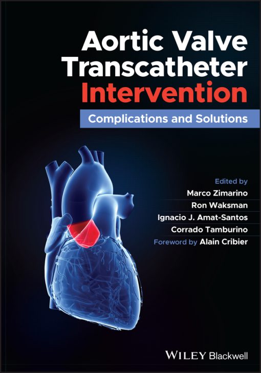 Aortic Valve Transcatheter Intervention: Complications And Solutions (EPUB)