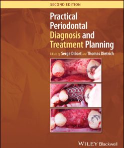 Practical Periodontal Diagnosis And Treatment Planning, 2nd Edition (EPUB)