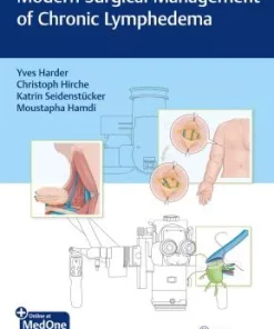 Modern Surgical Management Of Chronic Lymphedema (PDF)