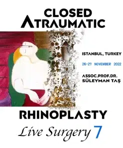 Closed Atraumatic Rhinoplasty Live Surgery DVD 7 (2 Cases: Rhinoplasty + FaceLift & NeckLift)