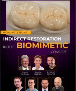 Indirect restoration in the biomimetic concept