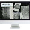 3D MR Imaging of Joints with Arthroscopy Correlations