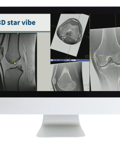 3D MR Imaging of Joints with Arthroscopy Correlations