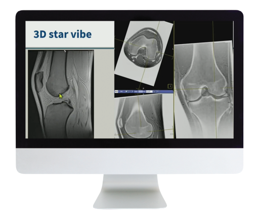 3D MR Imaging of Joints with Arthroscopy Correlations