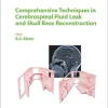 Comprehensive Techniques In CSF Leak Repair And Skull Base Reconstruction (Advances In Oto-Rhino-Laryngology Book 74) (EPUB)