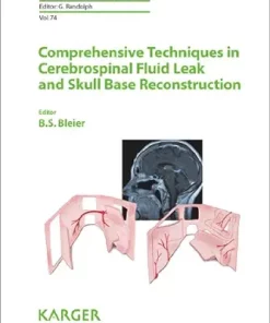 Comprehensive Techniques In CSF Leak Repair And Skull Base Reconstruction (Advances In Oto-Rhino-Laryngology Book 74) (EPUB)