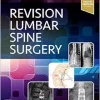 Revision Lumbar Spine Surgery (EPUB)