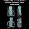 Fetal And Perinatal Skeletal Dysplasias: An Atlas Of Multimodality Imaging 2e (PDF)