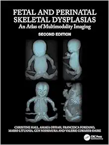 Fetal And Perinatal Skeletal Dysplasias: An Atlas Of Multimodality Imaging 2e (PDF)