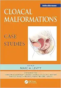 Cloacal Malformations: Case Studies (Pediatric Colorectal Surgery) (PDF)