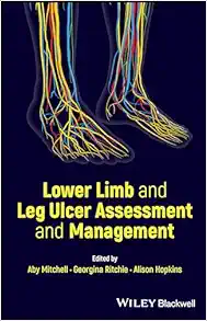 Lower Limb And Leg Ulcer Assessment And Management (PDF)