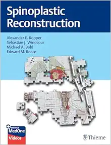 Spinoplastic Reconstruction (PDF+Videos)