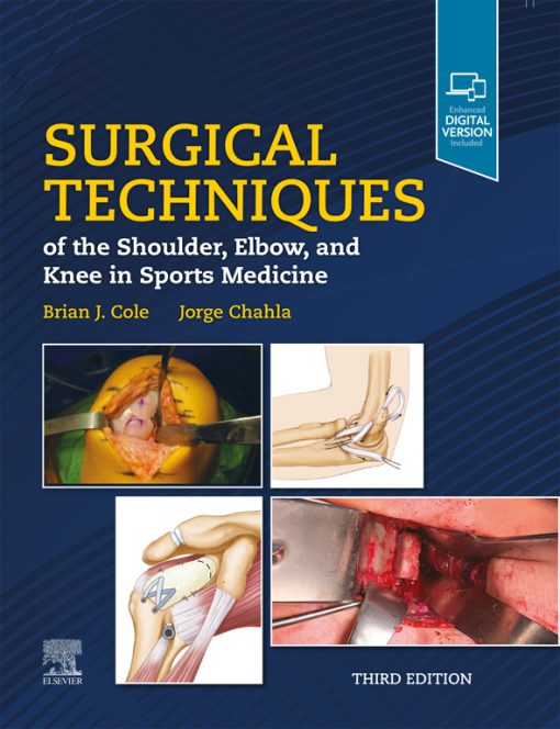 Surgical Techniques Of The Shoulder, Elbow, And Knee In Sports Medicine, 3rd Edition (EPUB)