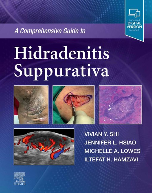 A Comprehensive Guide To Hidradenitis Suppurativa (EPUB)