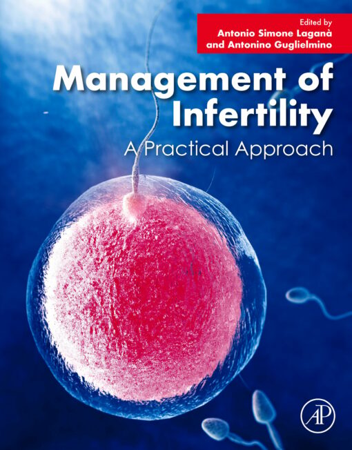 Management Of Infertility: A Practical Approach (EPUB)