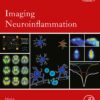 Imaging Neuroinflammation, Volume 9 (EPUB)