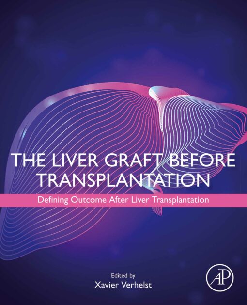 The Liver Graft Before Transplantation: Defining Outcome After Liver Transplantation (PDF)