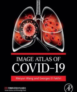 Image Atlas Of COVID-19 (EPUB)