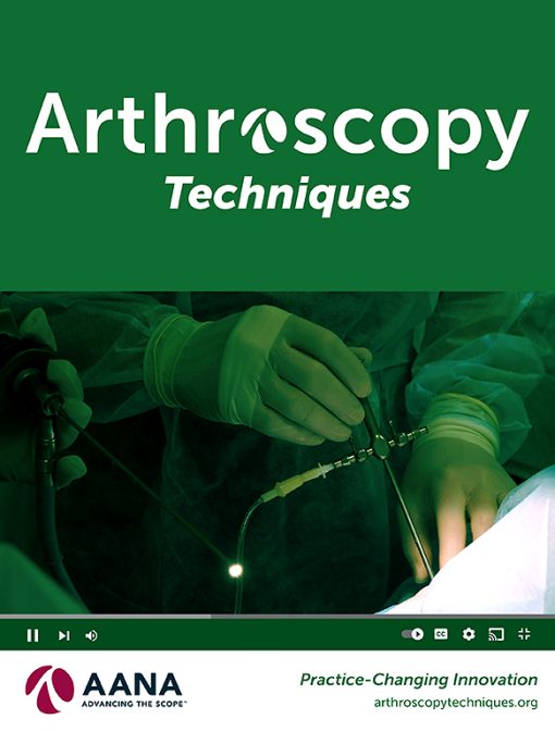 Arthroscopy Techniques PDF