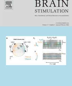 Brain Stimulation PDF