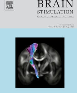 Brain Stimulation PDF