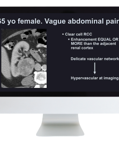 Case Review of Abdominal Imaging