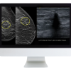 Case Review of Breast Imaging