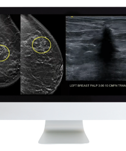 Case Review of Breast Imaging