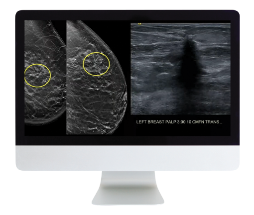 Case Review of Breast Imaging