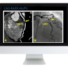 Case Review of Cardiopulmonary Imaging