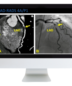 Case Review of Cardiopulmonary Imaging