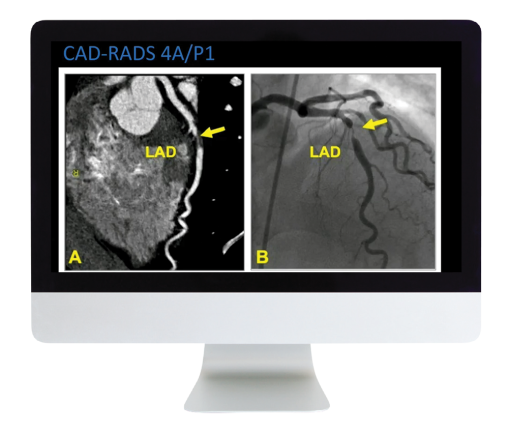 Case Review of Cardiopulmonary Imaging