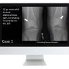 Case Review of Musculoskeletal Imaging