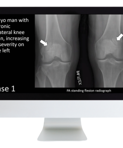 Case Review of Musculoskeletal Imaging