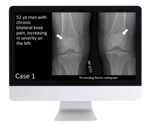 Case Review of Musculoskeletal Imaging