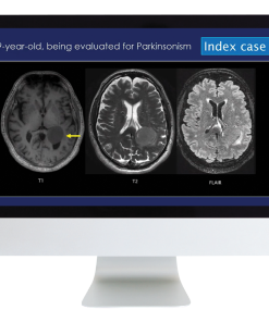 Case Review of Neuroradiology