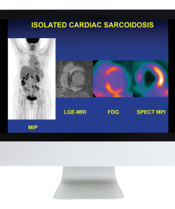 Case Review of Nuclear Medicine